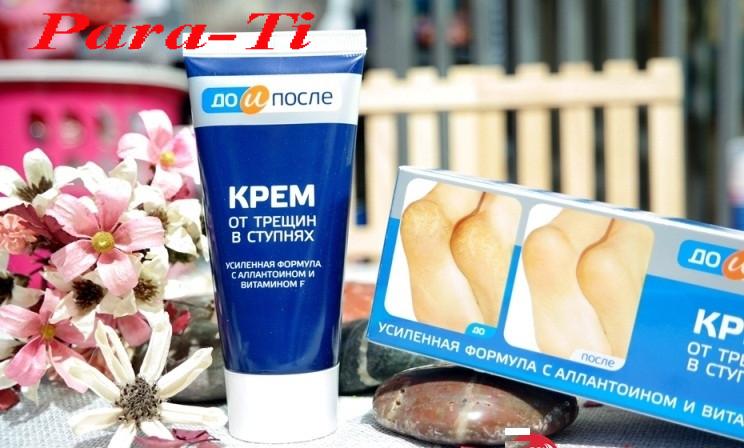 Kem chống nứt nẻ gót chân KPEM - Nga