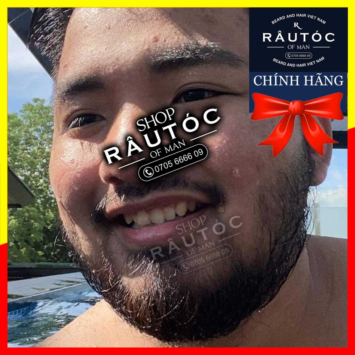 [HCM]Minoxidil 5% Rogaine
