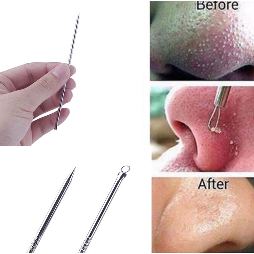 Cây Nặn Mụn 2 Đầu - Que Nặn Mụn Không Gỉ