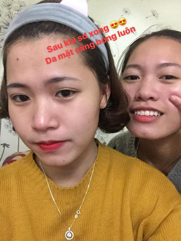 Tinh Chất Thay Da Sinh Học So’Natural Red Peel Tingle Serum