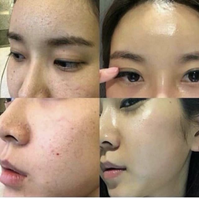 Thay Da Sinh Học RED PEEL TINGLE SERUM (Dạng gói)