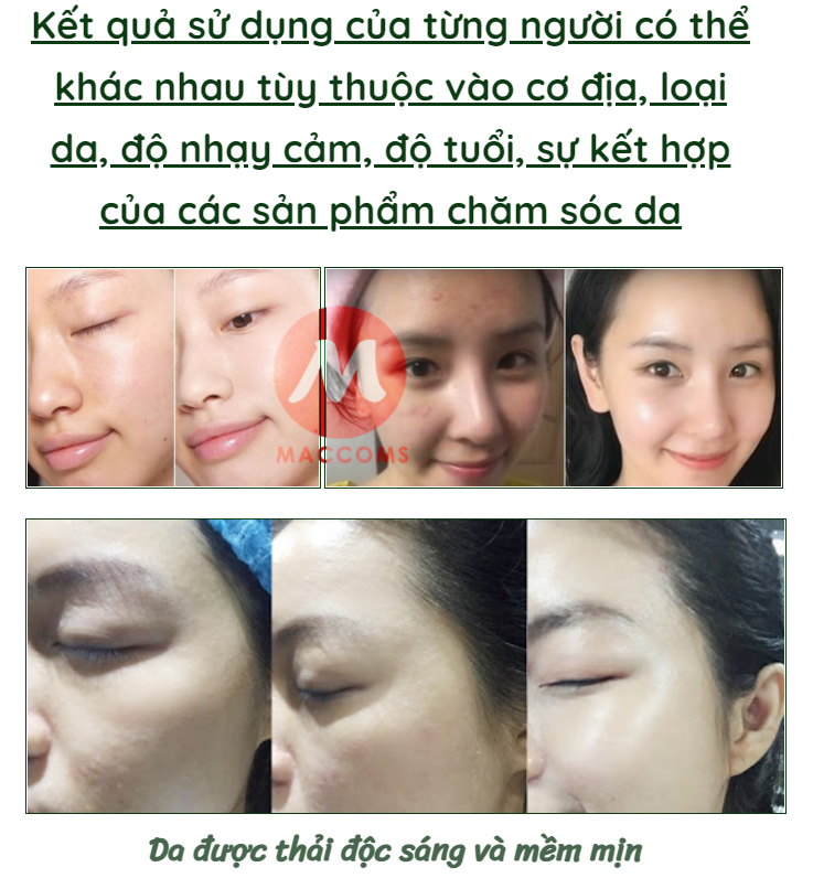 Mặt Nạ Ngủ Thạch Collagen YANJIAYI Hộp 20 Gói - Nâng Cơ Bổ Sung Collagen Căng Mịn Da Cấp Nước Dưỡng Ẩm Thu nhỏ lỗ chân lông