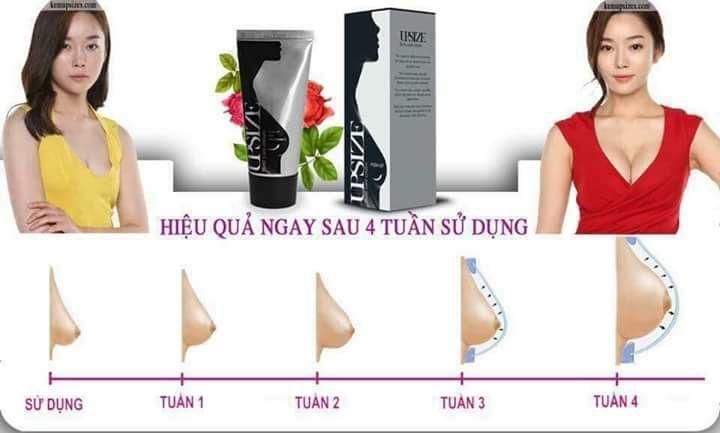 Kem nở ngực Upsize Nga