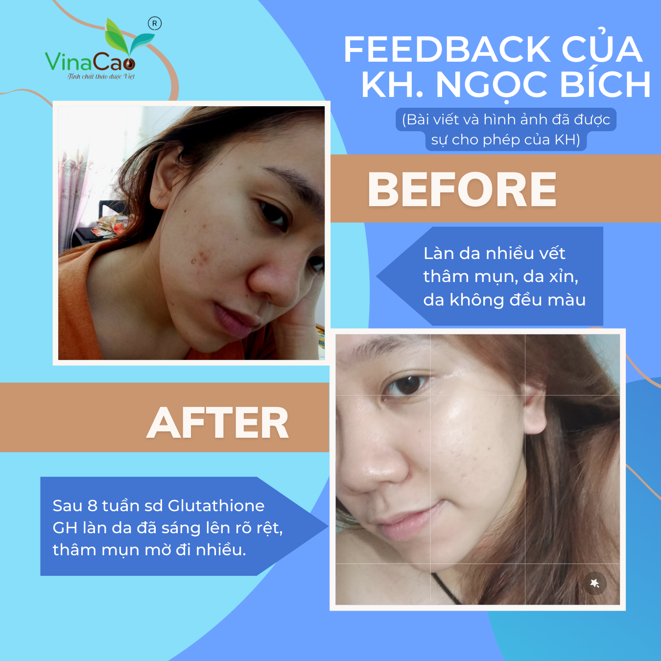 Viên uống trắng da Glutathione Collagen GH Vinacao - Hộp 60 viên - Giảm nám sạm da, tàn nhang, làm sáng da, trắng da, hạn chế quá trình oxi hóa; Tăng cường sức đề kháng, hệ miễn dịch