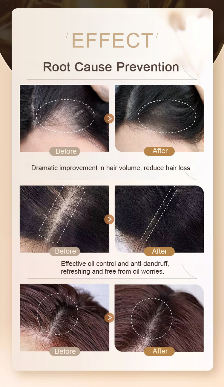 Anti-hair loss shampoo Ginger plant extract shampoo