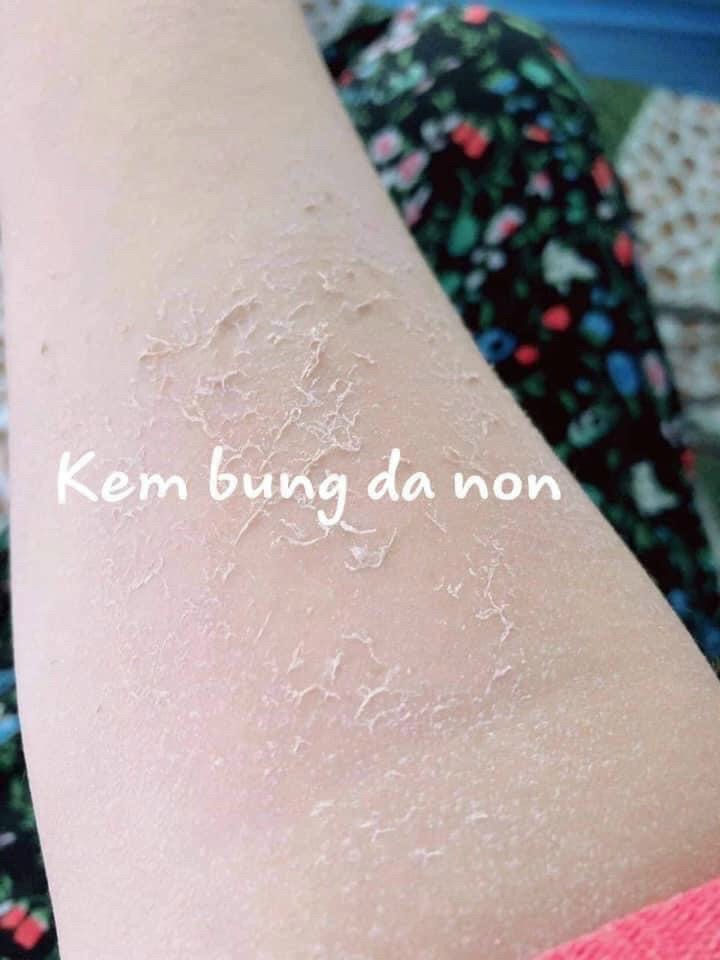 Kem Bong Da Tái Sinh Body 150g