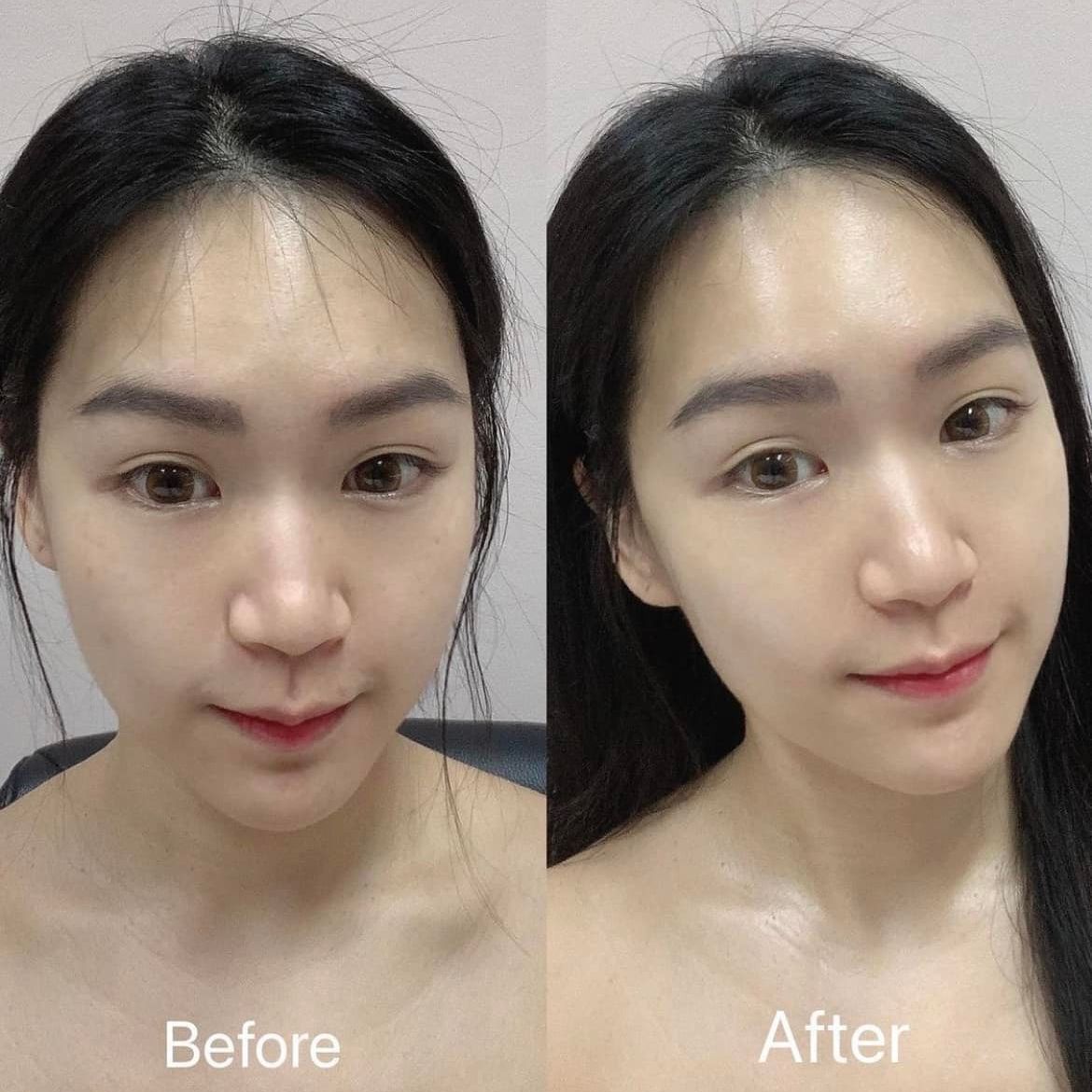 [MESO] Serum giữ ẩm cấp nước
