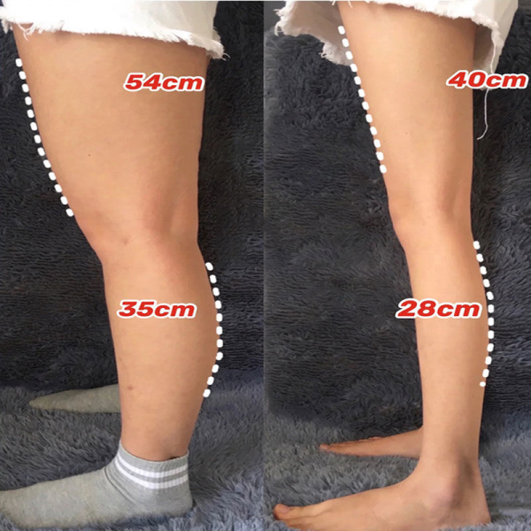 【Giảm béo nhanh chóng trong  7 ngày 】Giảm cân đốt cháy mỡ thừa. Trung y dán rốn dán bụng thon dán giảm cân sản phẩm giảm cân Miếng dán giảm cân không từ trường nâng cấp phiên bản mới