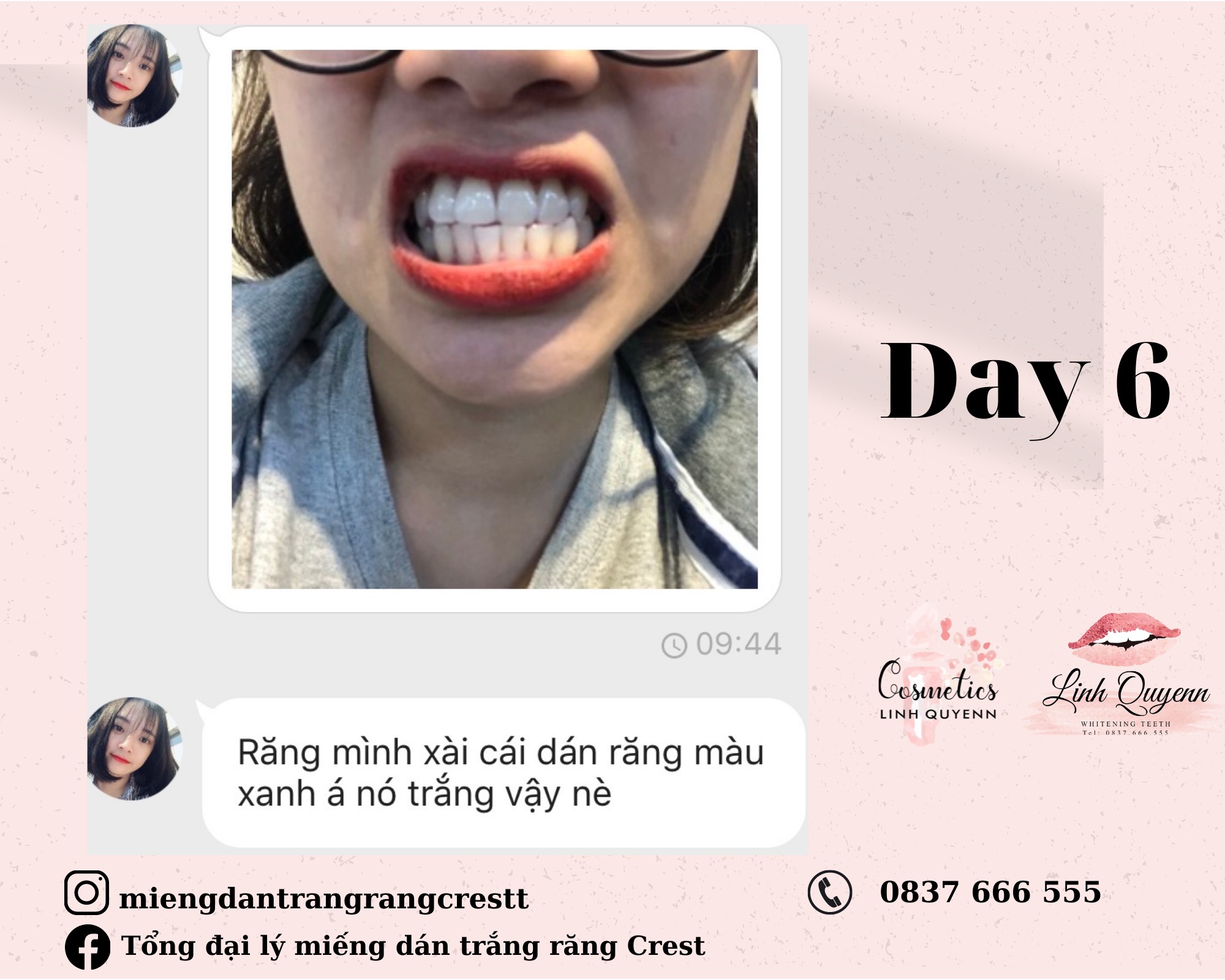 Kem đánh răng Crest Baking Soda & Peroxide Whitening 161G - Làm trắng răng