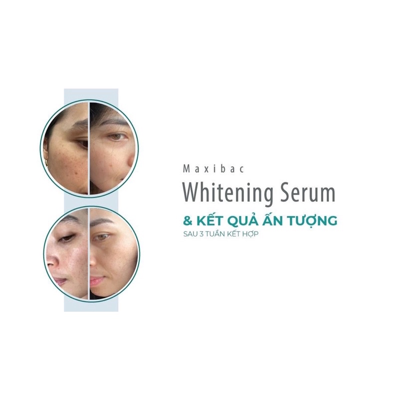 Maxibac Whitening Serum giúp làm sáng da, mờ nám