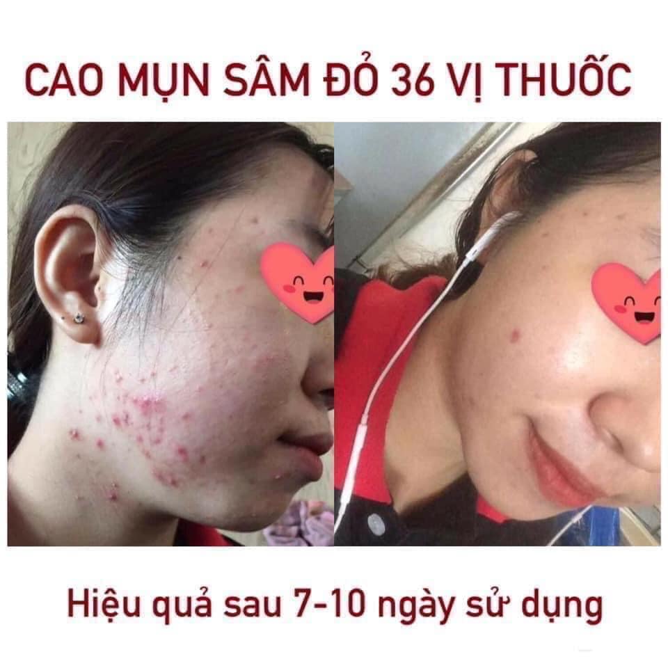 Cao Mụn Sâm Đỏ 36 Vị Meea Organic Giảm Mụn Mờ Thâm 15g