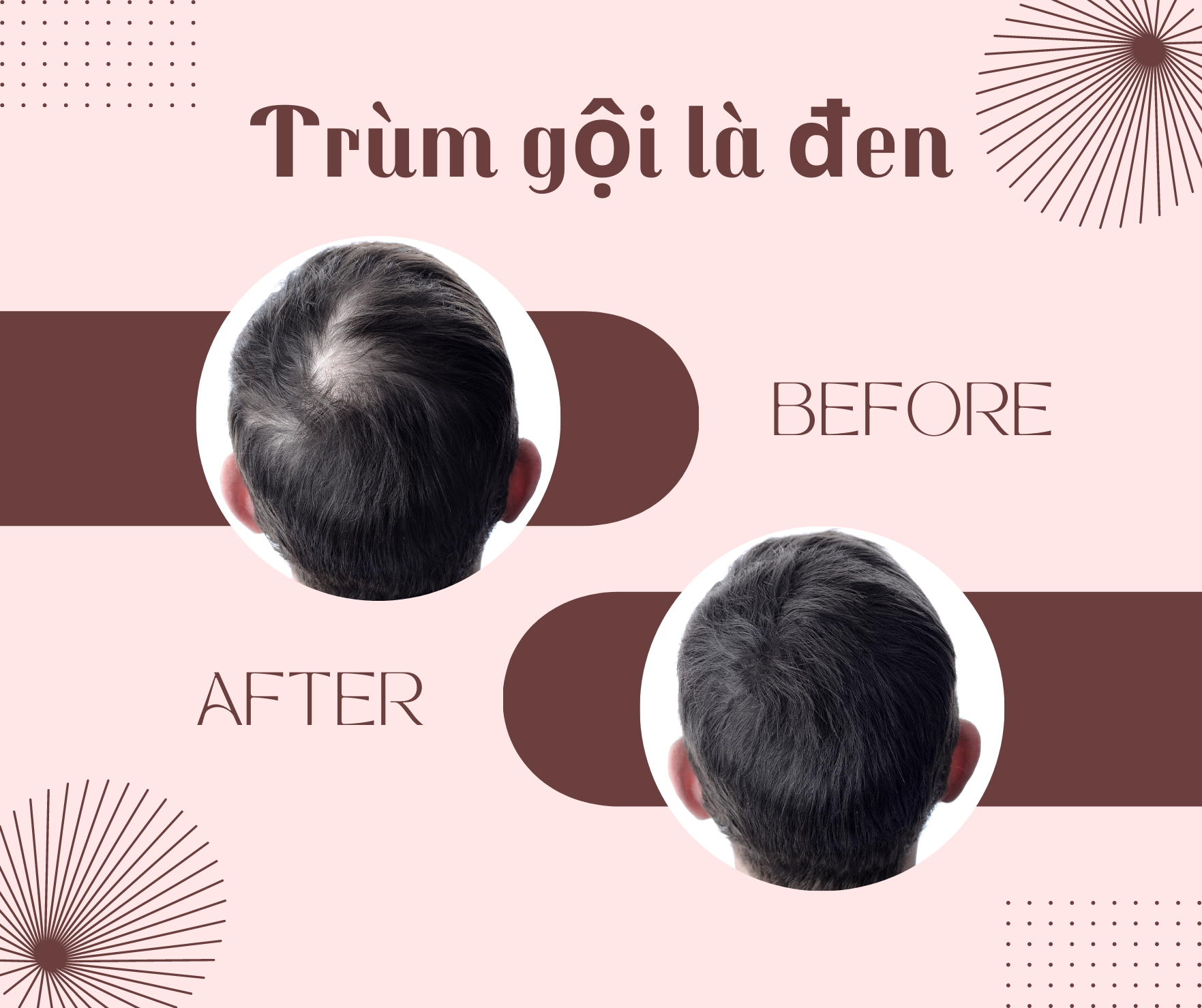 DẦU GỘI LÀ ĐEN COLLAGEN THẢO DƯỢC TÚI BƠ 500ml X 2