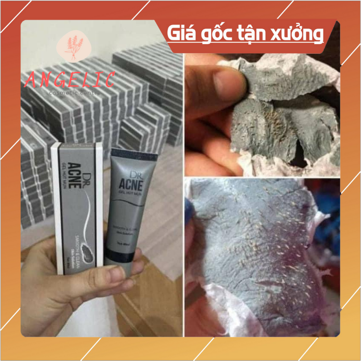 (COMBO 10 HÔP) Lột mụn đầu đen acne