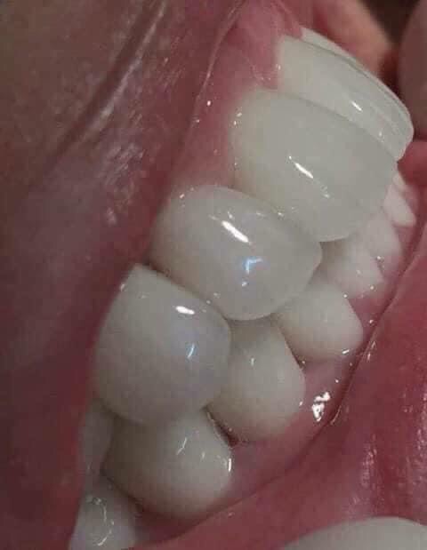Gói dùng thử bột đánh trắng răng 100gam