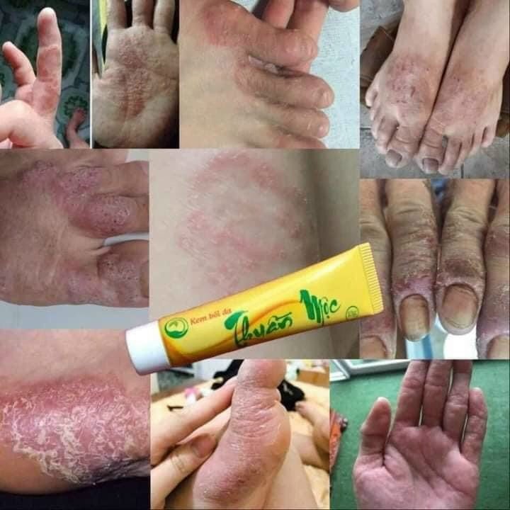 kem bôi da thuần mộc
