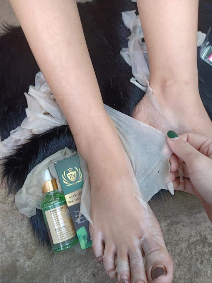 [Tặng 2 serum kích trắng] Combo nước lột bạc hà + Kem body cốt mạnh mix