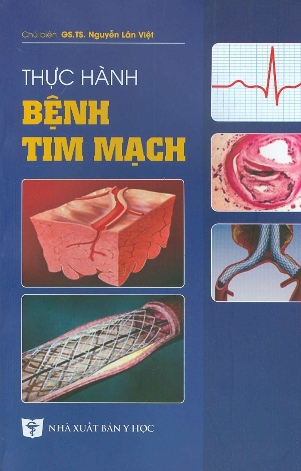 Thực Hành Bệnh Tim Mạch