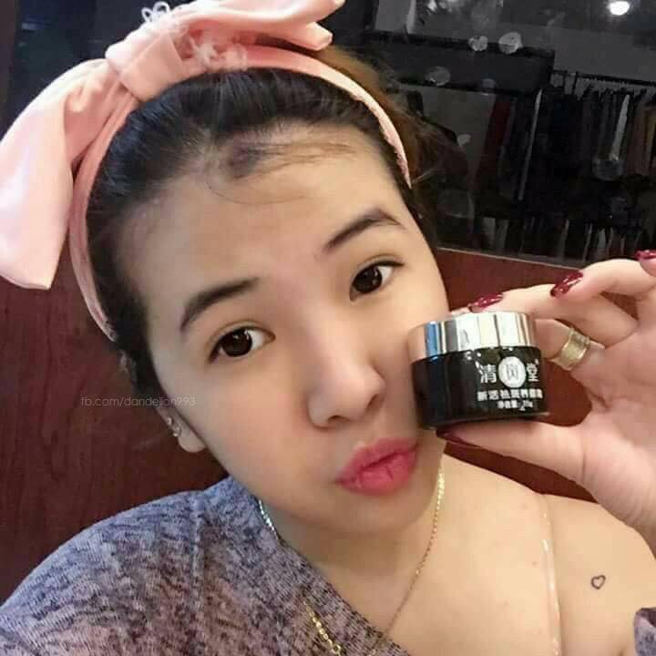 Kem Vua trị nám của Nhật Bản