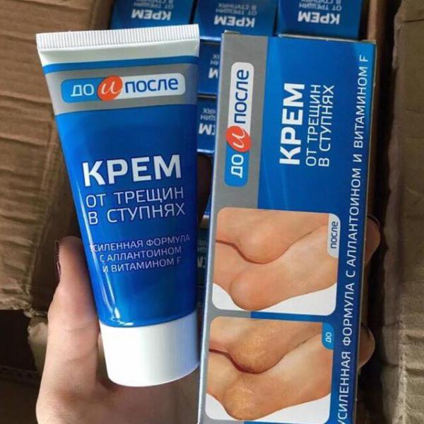 Kem xóa nứt nẻ, dưỡng gót chân Apteka Nga