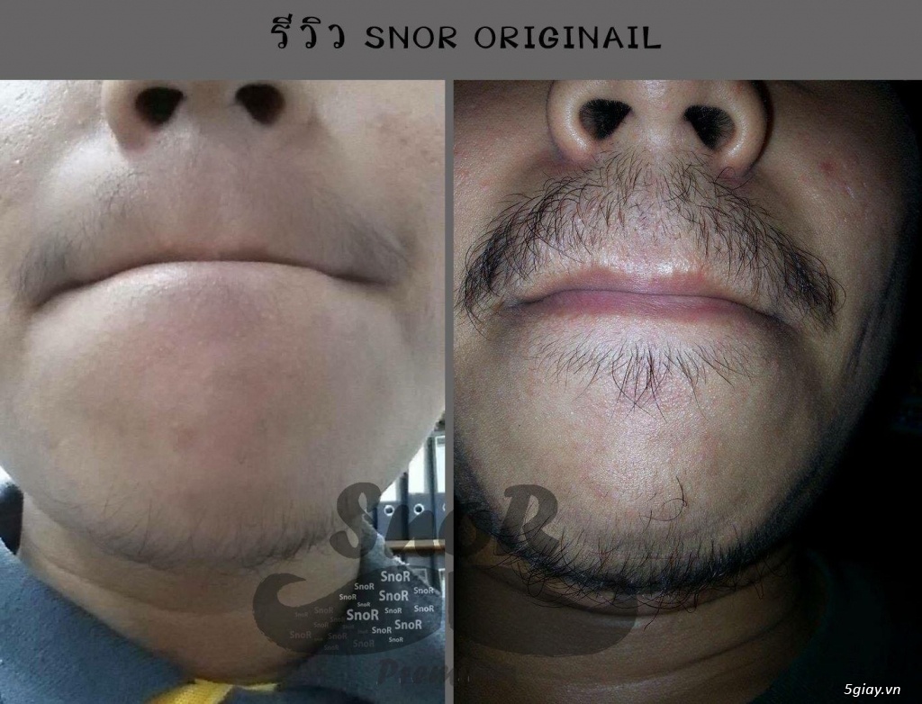 Serum kích thích mọc râu lông mày tóc Snor