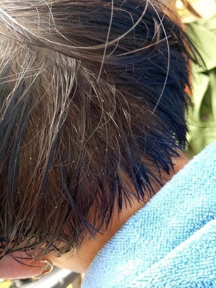 Thảo dược ủ chấy