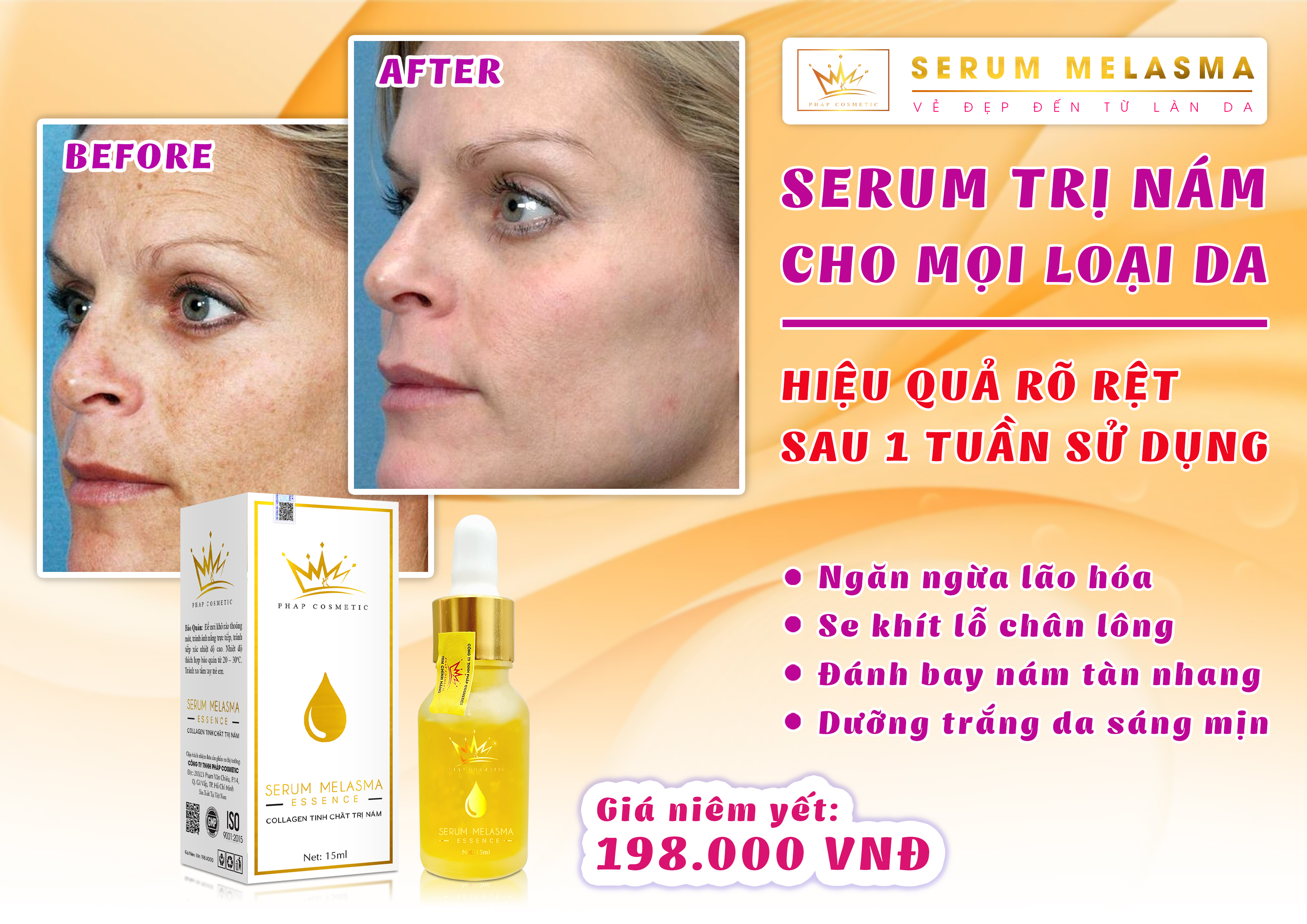 SERUM PHÁP NÁM MELASMA