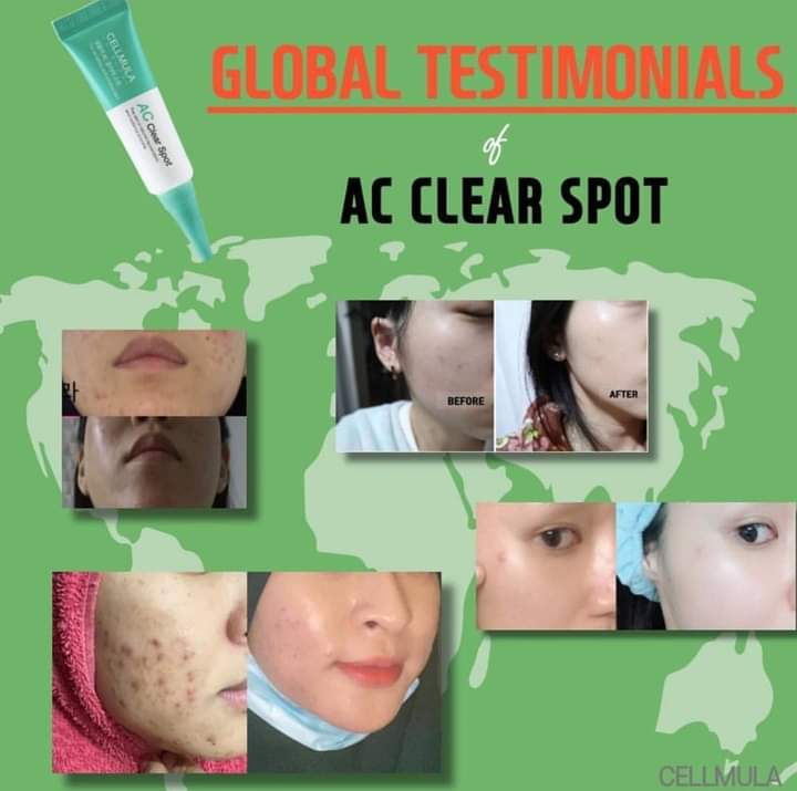 Kem Chấm Mụn Cellmula Ac Clear Spot