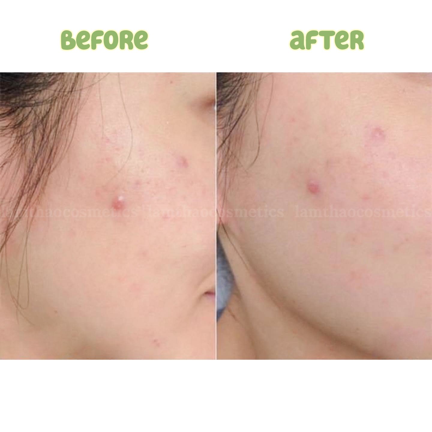 Sữa Rửa Mặt Naruko Tea Tree Purifying Clay Mask & Cleanser 120g