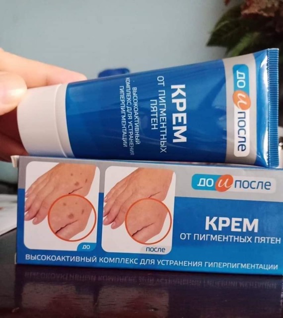 Kem  đồi mồi Nga