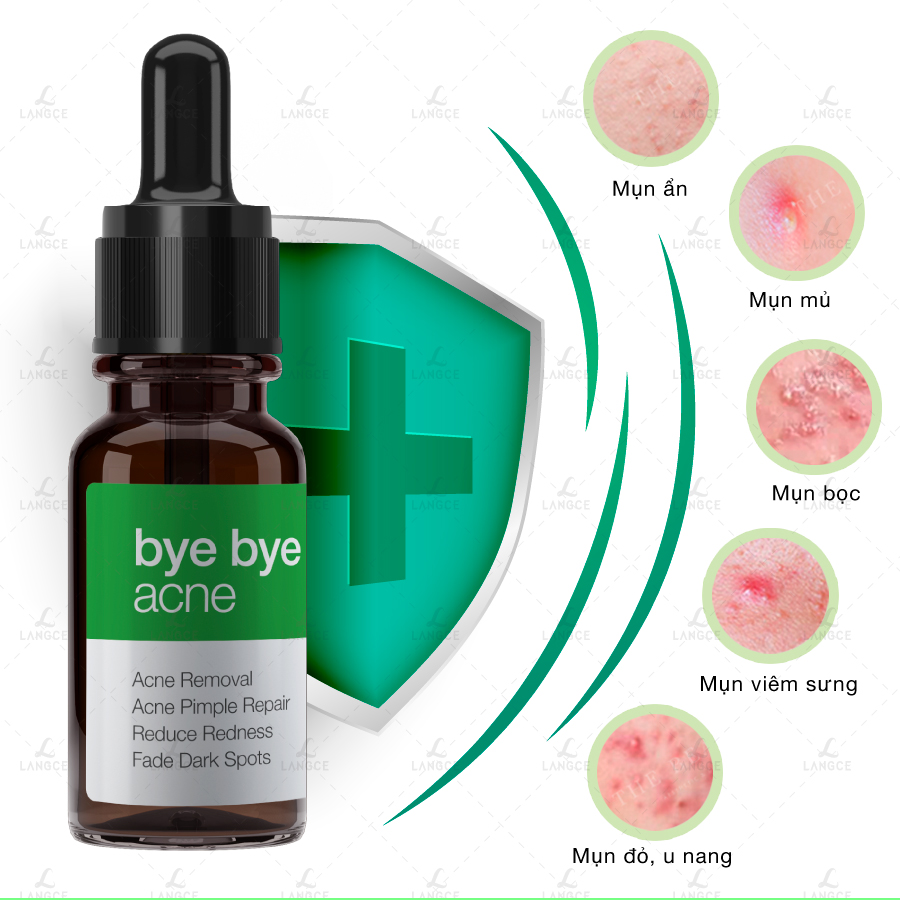 TẠM BIỆT MỤN BYE BYE BLEMISH for Acne LANGCE
