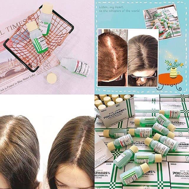 (chất lượng) KÍCH THÍCH MỌC TÓC THẢO DƯỢC NHẬT BẢN SATO