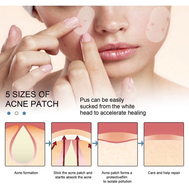 80Pcs Pimple Patch Makeup Invisible Hydrocolloid Comedo Patches
