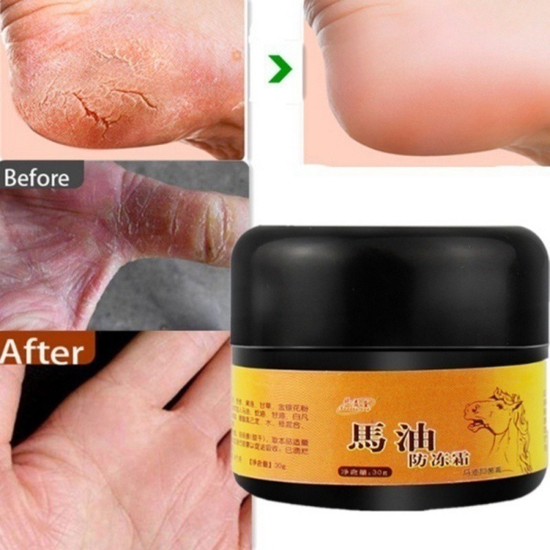 Kem bôi nứt nẻ gót chân tay con ngựa