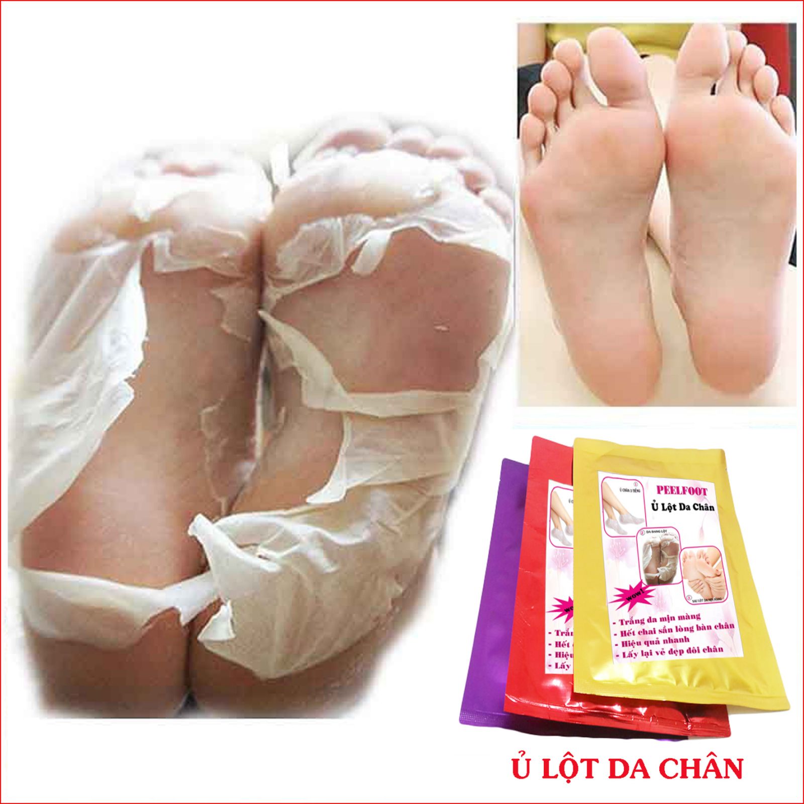 [HCM]Feelfoot Ủ Lột Da Chân Trắng Da Hết Chai Sần