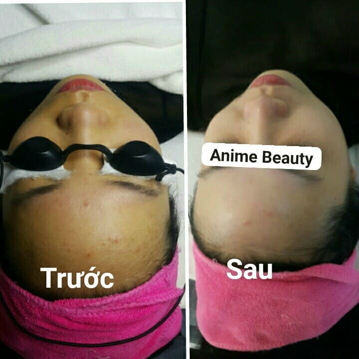 Mặt nạ ủ trắng hoa anh đào Sakura  (MUA 5 TẶNG 1)