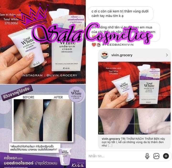 Kem bôi giảm thâm nách thâm bẹn khuỷu tay các vùng da thâm hot nhất thái lan