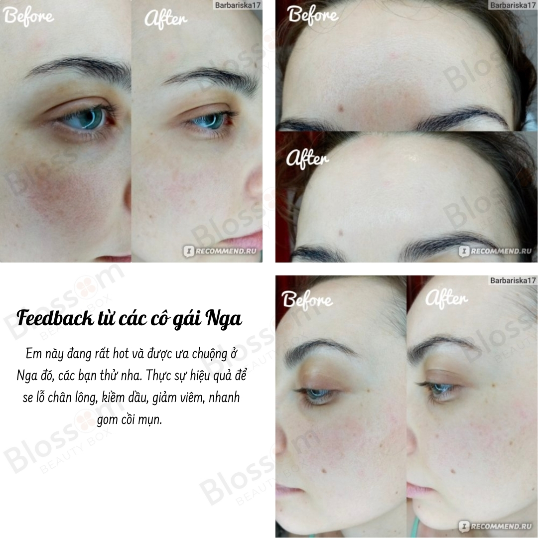 Mặt nạ Compliment Green Mask Giảm dầu, mụn 80ML