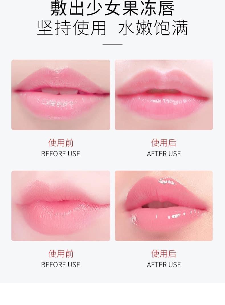 Nạ môi ZOZU 20 miếng