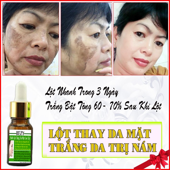 [HCM]Bộ Peel Trắng Da Mặt Tái Tạo Da