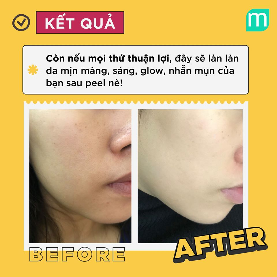Peel Da NeoStrata ProSystem Retinol Peel