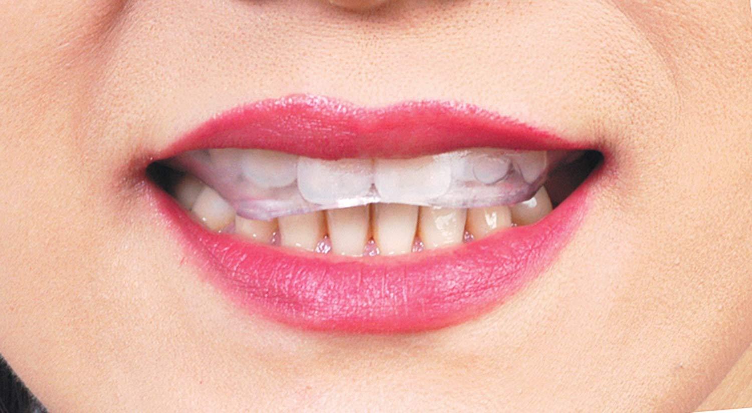 Máng DỤNG CỤ Chống nghiến răng Nhật Bản