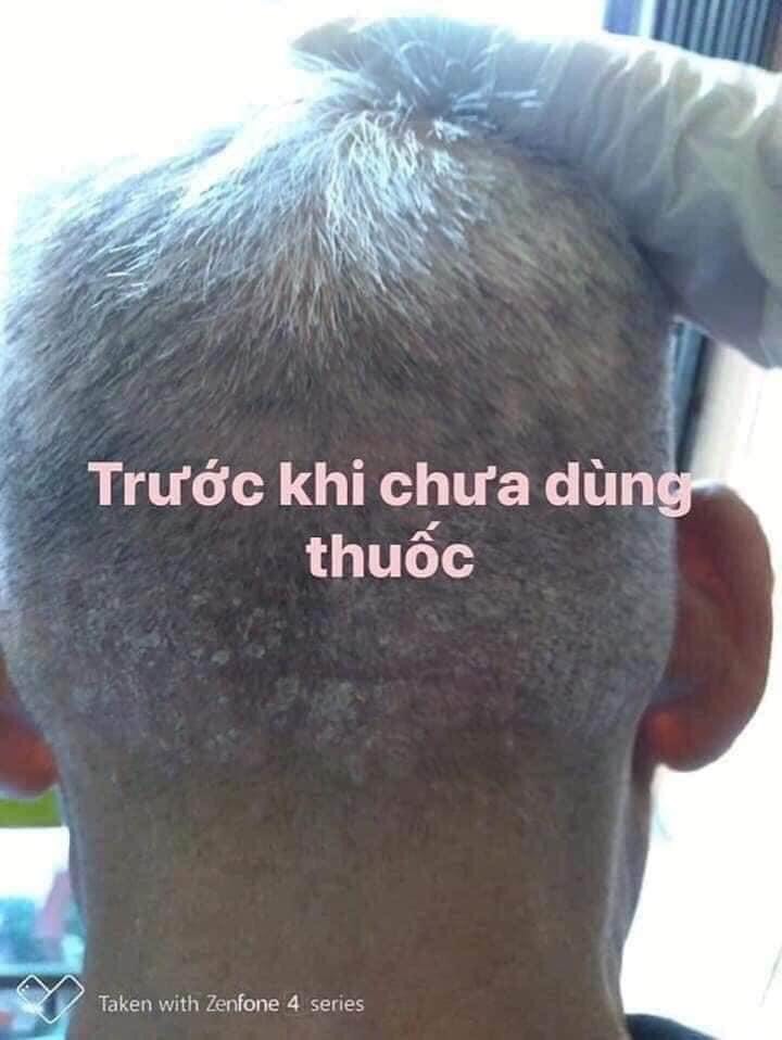 [HCM]Kem bôi da Thảo Mộc Nam