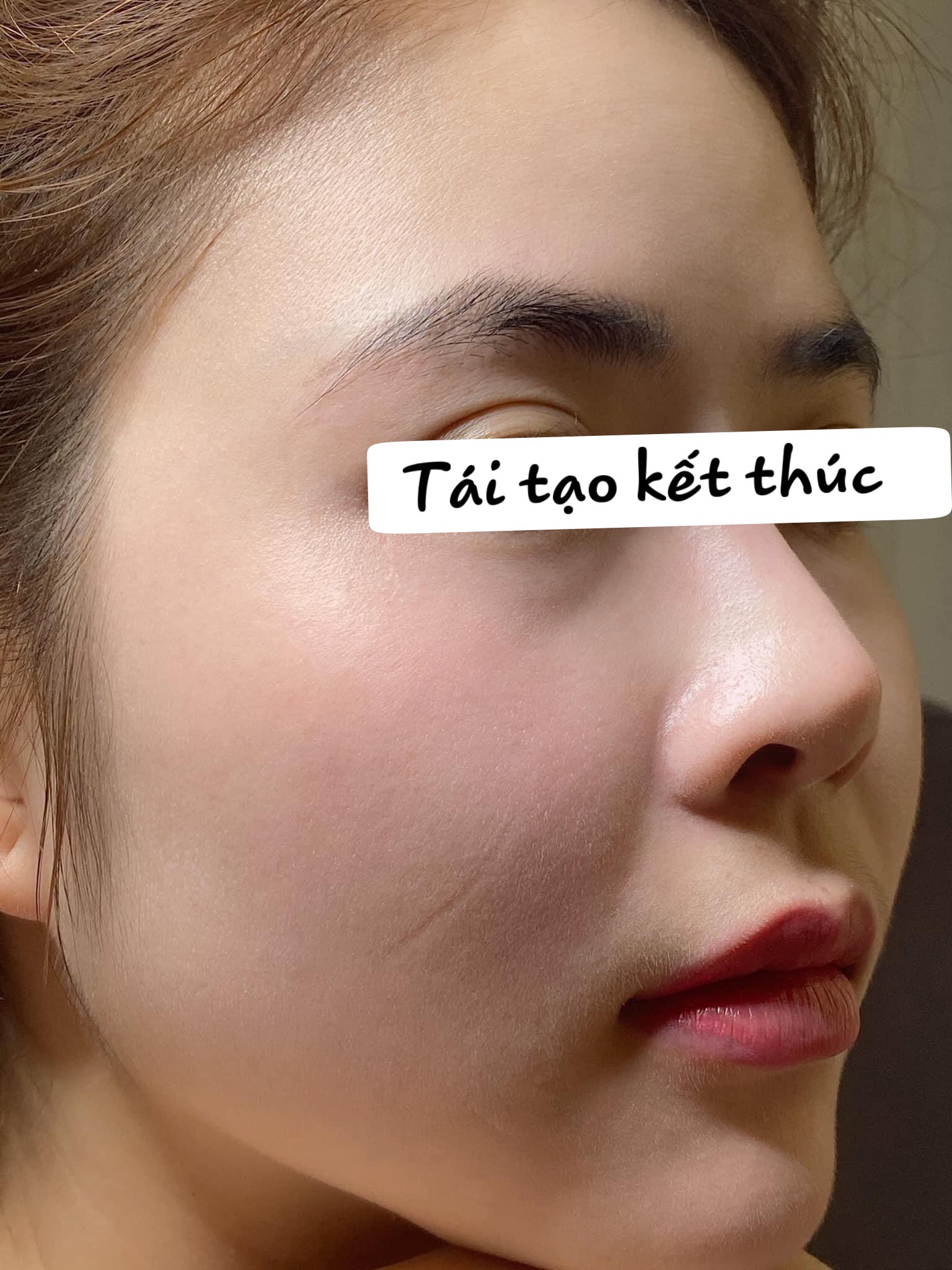 Tái Tạo Miracle 50ml