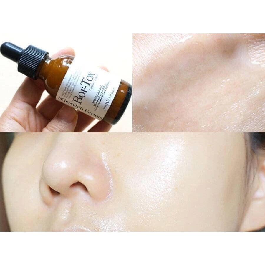 Serum căng bóng da Bortox Medi Peel