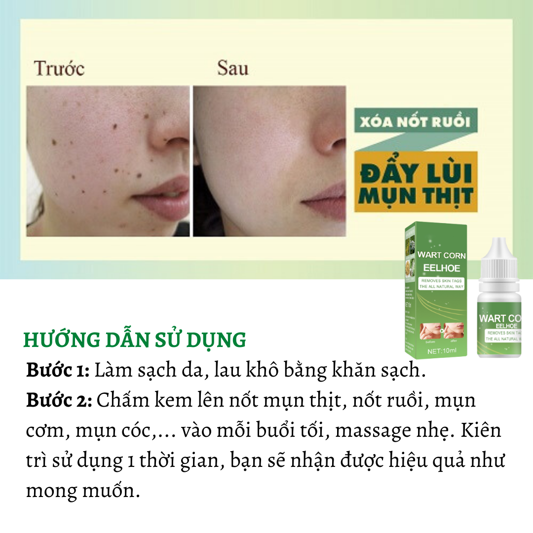 Dung dịch tẩy nốt ruồi EELHOE thần thánh tẩy nốt ruồi xóa mụn ruồi trên mặt, tàn nhang, mụn cóc, mụn thịt , mụn cơm, mắt cá tại nhà an toàn giúp bạn xóa đi khuyết điểm trên khuôn mặt