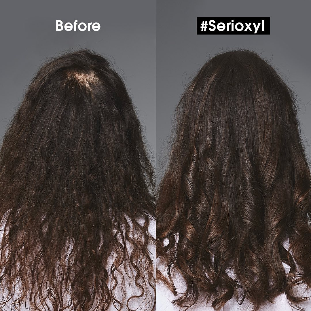 Combo làm sạch & giúp cải thiện mật độ tóc L'Oréal Professionnel Scalp Advanced - Dầu gội 500ml, Dưỡng chất 200ml