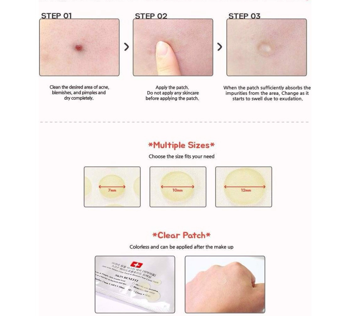 Miếng Dán Mụn Cosrx Acne Pimple Master Patch 24 Miếng Màu Đỏ | Hút Mụn Clear Fit Master Patch 18 Miếng Màu Đen (Mã 36)