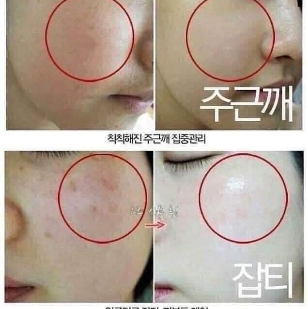 [HCM]KEM DƯỠNG TRẮNG DA MELASMA-X 3D GLUTATHIONE