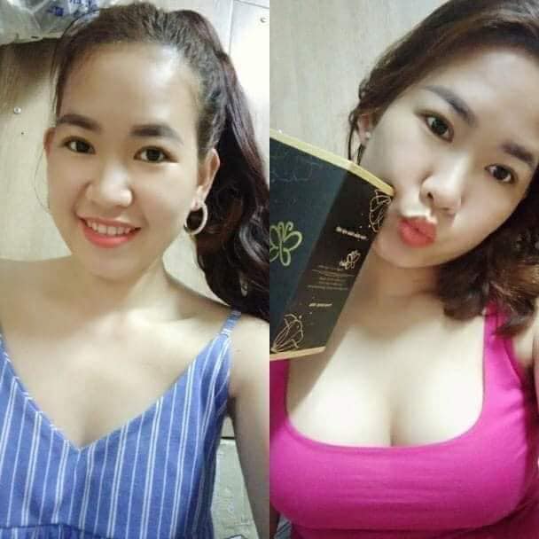 Thủy Mộc Đơn - Điều Huyết Briar
