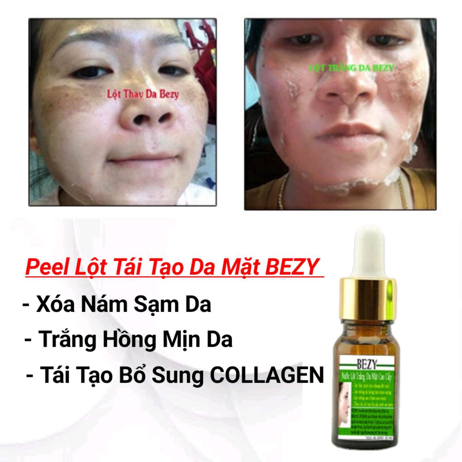 Peel Trắng Bong Da Xóa Nám Sạm
